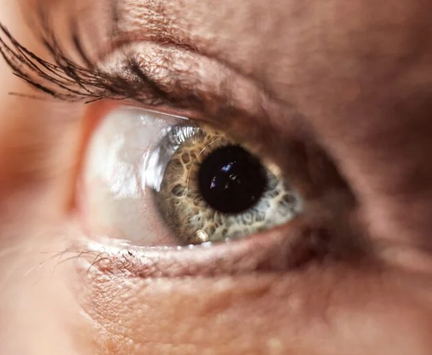 persona con occhio argentato e nero, chirurgia della palpebra