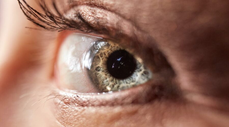 persoon met zilver en zwart oog, ooglidcorrectie